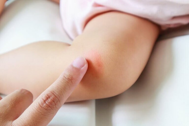 Genetik: Punca bayi kulit kering?