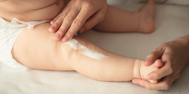 Petua Hilangkan Ruam Bayi Bawah Setahun. Ini 6 List To Do Wajib Buat. Penting Untuk Rawatan Awal!