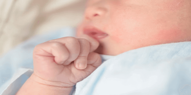 9 Petua Rawat Ruam Bayi Dengan Selamat, Bebas Bahan Kimia!